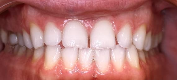 Case 2 after