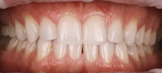 Case 2 before
