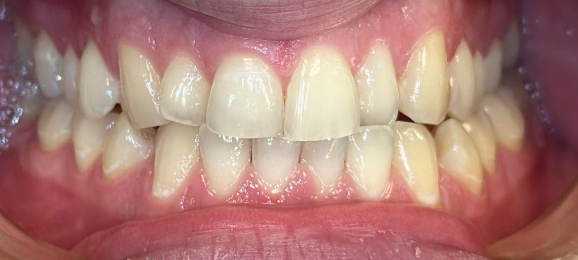 Case 5 before