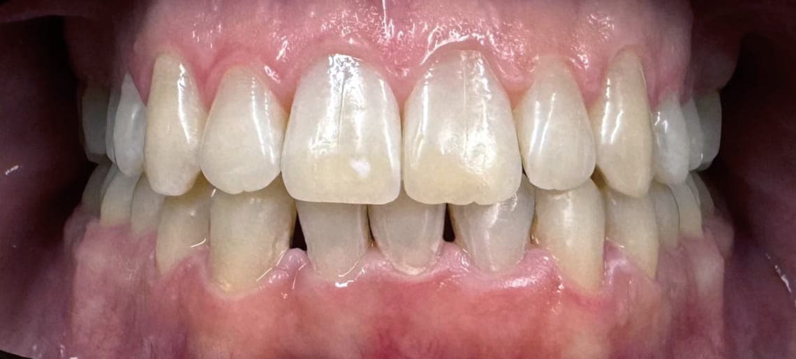 Case 7 after