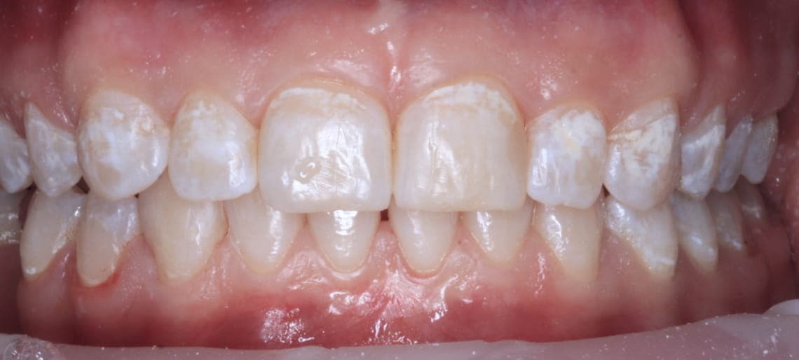 Case 8 after
