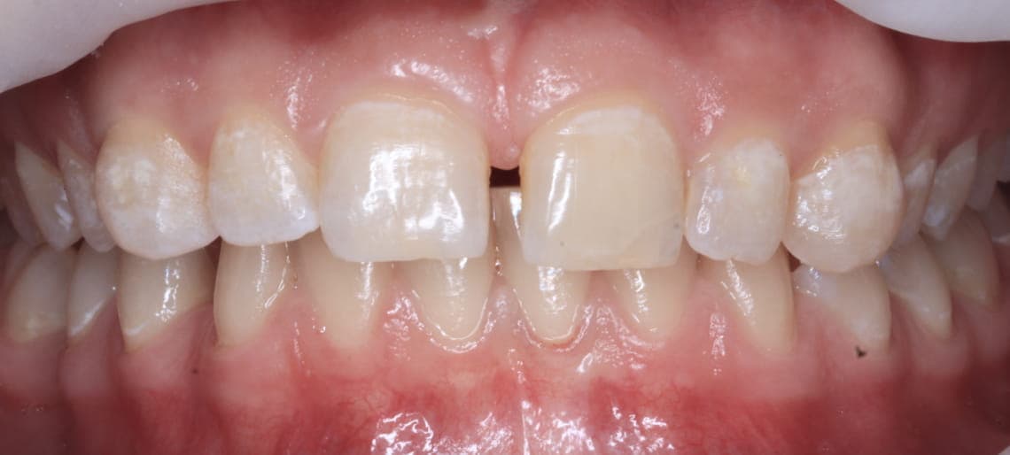 Case 8 before